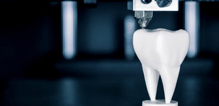 The Advantages of 3D Printing in Dentistry