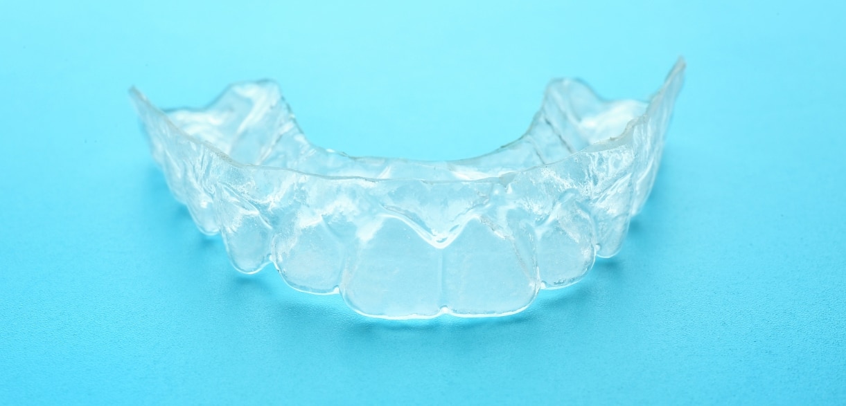 Top Tips for Maintaining Occlusal Guard in Chicago