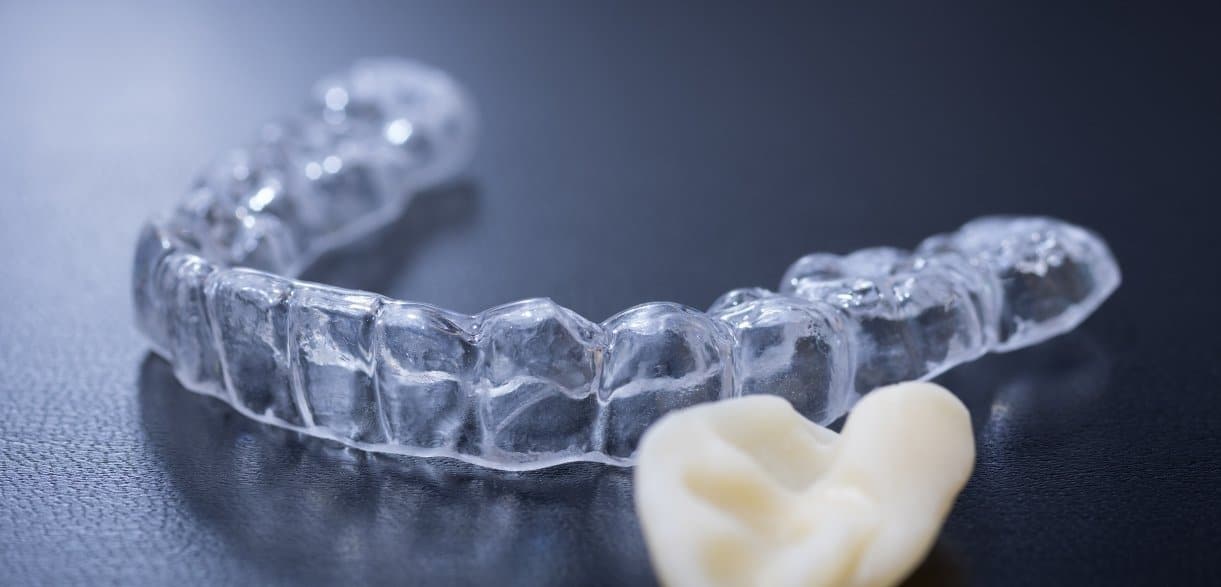Managing Jaw Pain: How Occlusal Guards Help