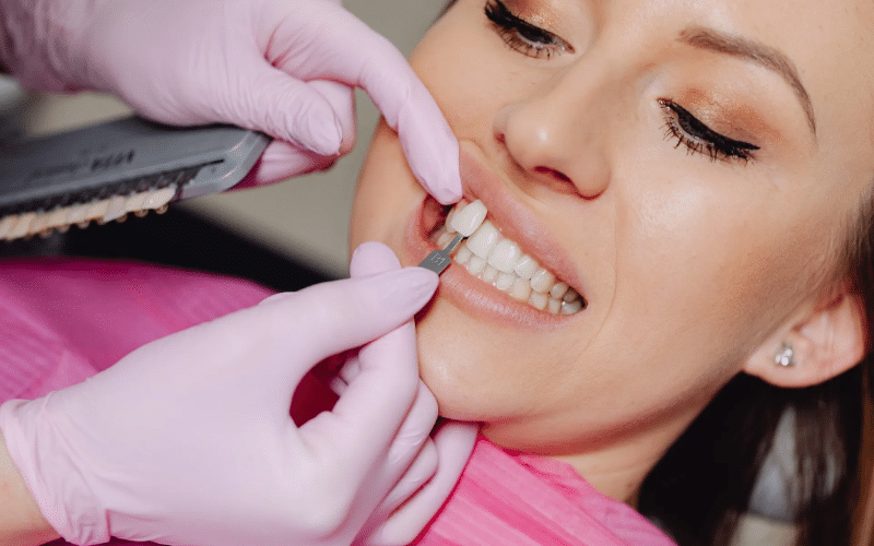 10 Reasons Porcelain Veneers Are Worth It