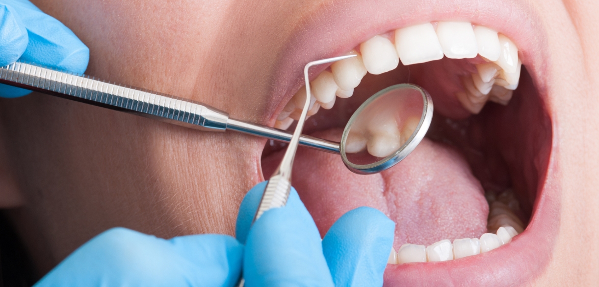 Causes of Crumbling Teeth & Emergency Dentistry Solutions
