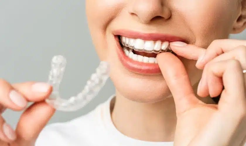 What To Do If Your Invisalign Aligner Is Cutting Your Gums